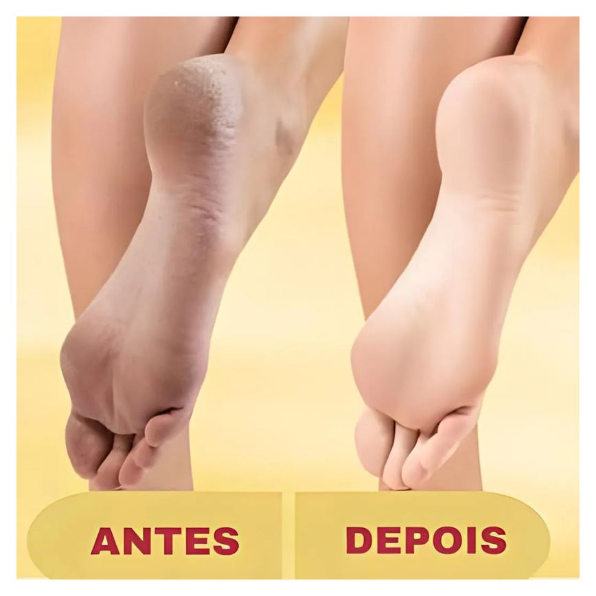 Lixa Elétrica Esfoliador Pés Recarregável Removedor de Calos + Creme Hidratante