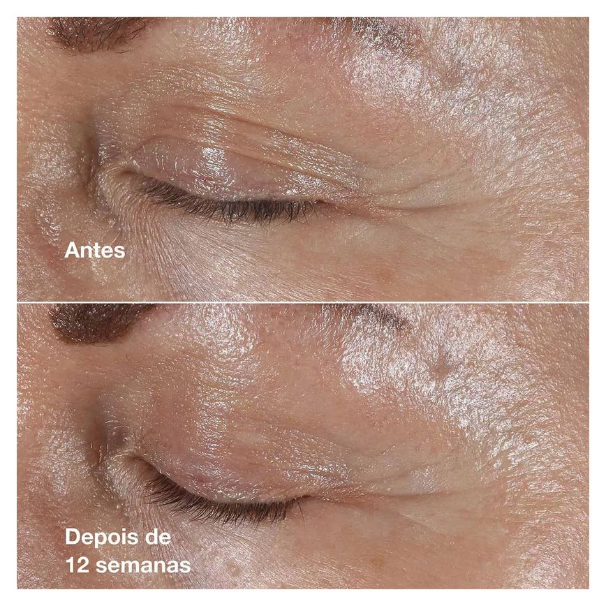 Creme Antirrugas Clinique Smart Repair Para Área dos Olhos 15ml